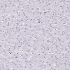 Immunohistochemical staining of human liver shows no positivity in hepatocytes as expected.