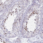 Anti-OXLD1 Antibody
