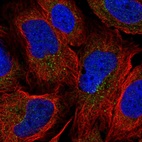 Immunofluorescent staining of human cell line U-2 OS shows localization to vesicles.