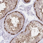 Immunohistochemical staining of human testis shows high expression.