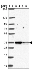Lane 1: Marker [kDa] 250, 130, 95, 72, 55, 36, 28, 17, 10_br/_Lane 2: Human cell line RT-4_br/_Lane 3: Human cell line U-251 MG_br/_Lane 4: Human plasma_br/_Lane 5: Human Liver tissue_br/_Lane 6: Human Tonsil tissue