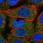 Immunofluorescent staining of human cell line MCF7 shows localization to cytosol.