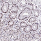 Anti-ZNF444 Antibody