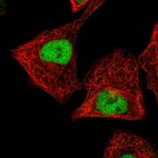 Immunofluorescent staining of human cell line A549 shows localization to nucleus.