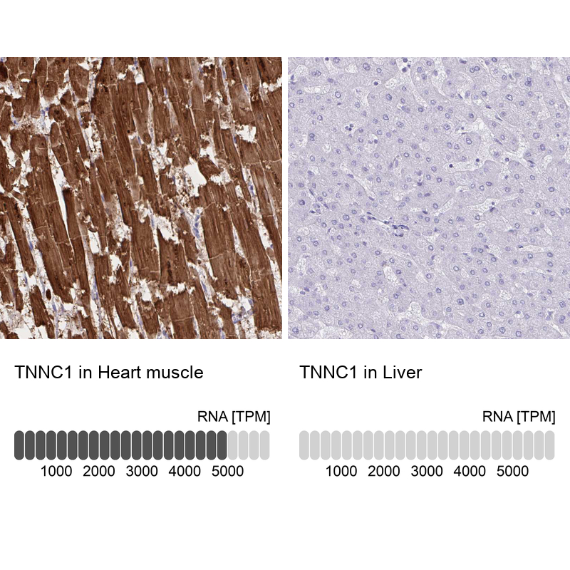 Anti-TNNC1 Antibody