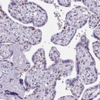 Immunohistochemical staining of human placenta shows moderate nuclear positivity in a subset of trophoblastic cells.