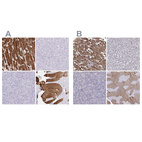 Anti-TNNC1 Antibody