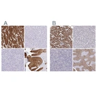 Immunohistochemical staining of human heart muscle, liver, pancreas and skeletal muscle using Anti-TNNC1 antibody HPA056897 (A) shows similar protein distribution across tissues to independent antibody HPA044848 (B).