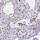 Anti-TEAD4 Antibody