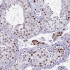 Immunohistochemical staining of human testis shows moderate nuclear positivity in a subset of cells in seminiferous ducts.