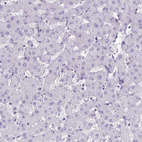 Anti-TEAD4 Antibody