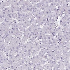 Immunohistochemical staining of human liver shows no positivity in hepatocytes as expected.