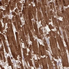 Immunohistochemical staining of human heart muscle shows strong cytoplasmic positivity in cardiomyocytes.