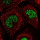 Immunofluorescent staining of human cell line A-431 shows localization to nucleoplasm.