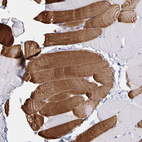 Anti-TNNC1 Antibody