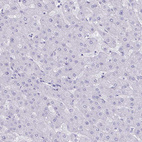 Anti-TNNC1 Antibody