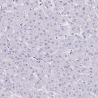 Immunohistochemical staining of human liver shows no positivity in hepatocytes as expected.