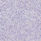 Anti-TNNC1 Antibody