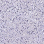 Immunohistochemical staining of human pancreas shows no positivity in exocrine glandular cells as expected.