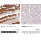 Anti-TNNT3 Antibody