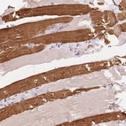 Immunohistochemical staining of human skeletal muscle shows high expression.