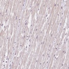 Immunohistochemical staining of human heart muscle shows low expression as expected.
