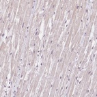 Anti-TNNT3 Antibody