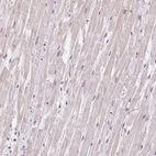 Immunohistochemical staining of human heart muscle shows low expression as expected.