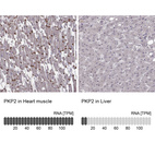 Anti-PKP2 Antibody