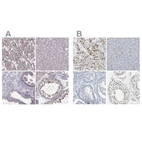 Immunohistochemical staining of human heart muscle, liver, prostate and testis using Anti-PKP2 antibody HPA056908 (A) shows similar protein distribution across tissues to independent antibody HPA014314 (B).