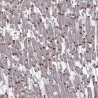 Immunohistochemical staining of human heart muscle shows strong positivity of intercalated discs.