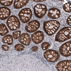 Immunohistochemical staining of human colon shows strong membranous positivity in glandular cells.