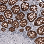 Immunohistochemical staining of human colon shows strong membranous positivity in glandular cells.