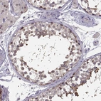 Immunohistochemical staining of human testis shows moderate nuclear positivity in cells in seminiferous ducts.