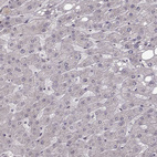 Immunohistochemical staining of human liver shows no positivity in hepatocytes as expected.