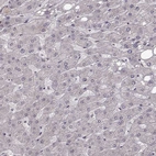 Immunohistochemical staining of human liver shows no positivity in hepatocytes as expected.