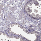 Immunohistochemical staining of human prostate shows low positivity in glandular cells as expected.