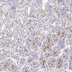 Anti-CGNL1 Antibody