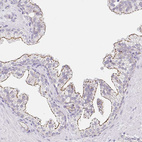 Anti-CGNL1 Antibody