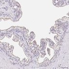 Immunohistochemical staining of human prostate shows moderate membranous positivity in glandular cells.