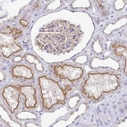 Immunohistochemical staining of human kidney shows strong membranous positivity in cells in tubules.