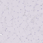 Immunohistochemical staining of human skeletal muscle shows no positivity in myocytes as expected.