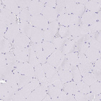 Anti-CGNL1 Antibody