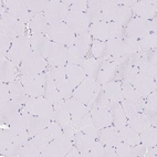 Immunohistochemical staining of human skeletal muscle shows no positivity in myocytes as expected.