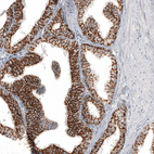 Immunohistochemical staining of human prostate shows strong membranous positivity in glandular cells.