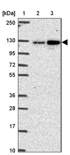 Lane 1: Marker [kDa] 250, 130, 95, 72, 55, 36, 28, 17, 10_br/_Lane 2: Human cell line RT-4_br/_Lane 3: Human cell line U-251 MG