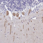 Anti-INTS5 Antibody