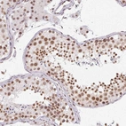 Immunohistochemical staining of human testis shows moderate nuclear positivity in cells in seminiferous ducts.