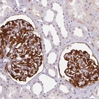 Immunohistochemical staining of human kidney shows strong cytoplasmic positivity in cells in glomeruli.