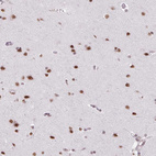 Immunohistochemical staining of human cerebral cortex shows strong nuclear positivity in neuronal cells.